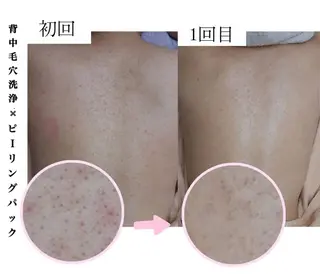 肌ケア&毛穴洗浄 Cheri/女性専用のエステ・リラクイメージ