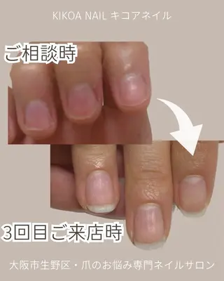 ネイル KIKOA NAIL キコアネイルのネイルデザイン