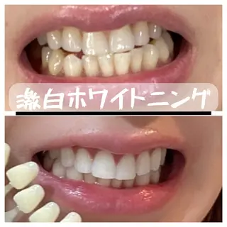 銀座de ホワイトニングのその他イメージ