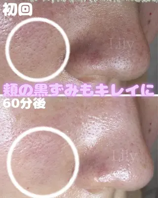 トータルビューティー サロンLilyのその他イメージ