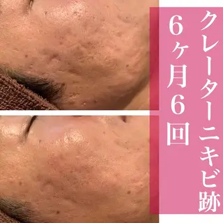 ミディアム カラー パーマ ヘアアレンジ メンズ キッズ ネイル マツエク・マツパ ニキビ・肌質改善専門 ♡人生が変わるサロンのエステ・リラクイメージ