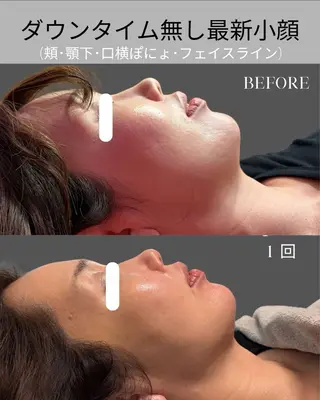 オンダリフト小顔・ ワックス脱毛×光脱毛のエステ・リラクイメージ