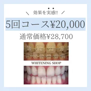 ホワイトニング ショップ倉敷店のエステ・リラクイメージ