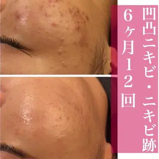 ミディアム カラー パーマ ヘアアレンジ メンズ キッズ ネイル マツエク・マツパ アイブロウ ニキビ・肌質改善専門 ♡人生が変わるサロンのエステ・リラクイメージ