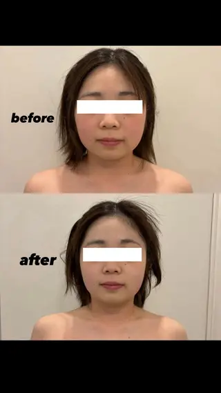 アンジェリック ビーナス Rinonのエステ・リラクイメージ