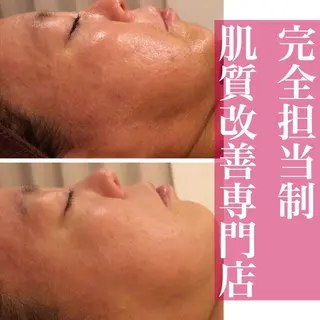 ミディアム カラー パーマ ヘアアレンジ メンズ マツエク・マツパ アイブロウ ニキビ・肌質改善専門 ♡人生が変わるサロンのエステ・リラクイメージ