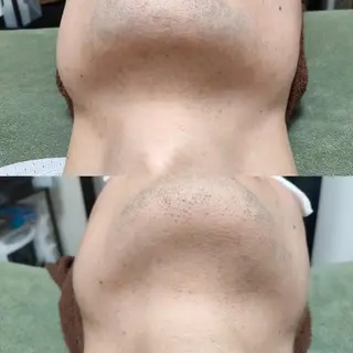 メンズ 武 藤のエステ・リラクイメージ