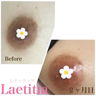 レティティア (Laetitia)のエステ・リラクイメージ