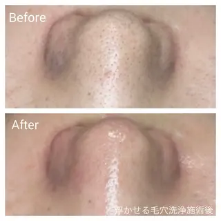 深い肌悩み&早期脱毛 完了サロンのエステ・リラクイメージ