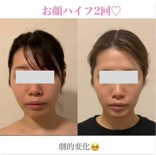 a room salonのエステ・リラクイメージ