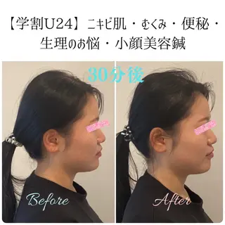 美容鍼&温活・免活 さくらんぼ鍼灸院のエステ・リラクイメージ