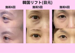 愛維美水光美肌専門店 メンズレディースokのエステ・リラクイメージ