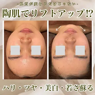 トラブル肌改善🏥 Meow！🫧🫧のエステ・リラクイメージ