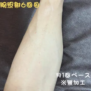 メンズ キッズ メンズ脱毛フェリッセ /男女🆗キッズ🆗のエステ・リラクイメージ