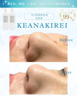 LiAm《美肌管理/ 小顔/脂肪ケア》のエステ・リラクイメージ