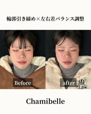 美容鍼灸サロン Chamibelleのエステ・リラクイメージ