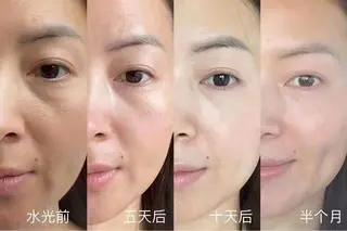 ネイル 愛維美水光専門店 川崎彩鳳のエステ・リラクイメージ