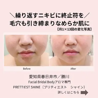 フェイシャル/ボディ /ブライダル山田浩子のエステ・リラクイメージ
