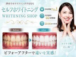 ホワイトニング ショップ津店のその他イメージ