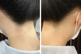 Hair Peace 脱毛サロンのエステ・リラクイメージ