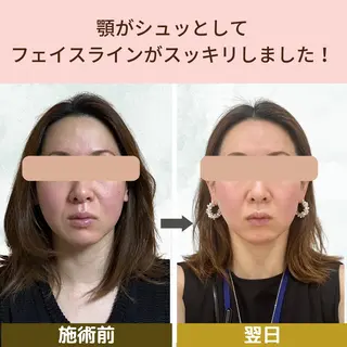 小顔&ヘッドスパ/ もりもとまきみのエステ・リラクイメージ
