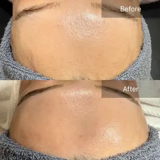 enine フェイスWAXのエステ・リラクイメージ