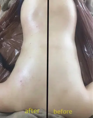 《本気痩せ×疲労改善 》  BILOOPのエステ・リラクイメージ