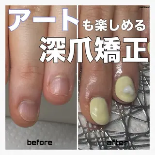 ネイル nail salon petillantのネイルデザイン