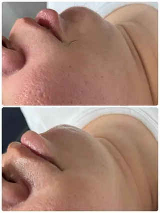 enine フェイスWAXのエステ・リラクイメージ