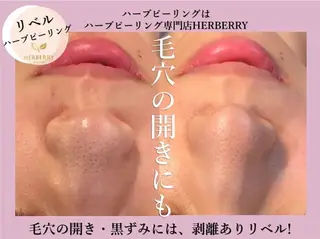 ハーブピーリング専門 HERBERRY冨永のエステ・リラクイメージ