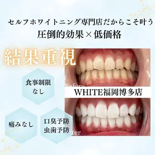 キッズ メンズ セルフホワイトニング WHITE福岡博多店のエステ・リラクイメージ