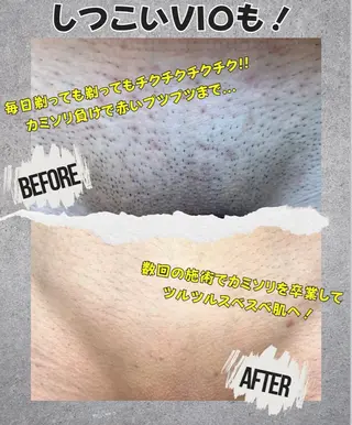 メンズ Neosalon ネオサロンのエステ・リラクイメージ