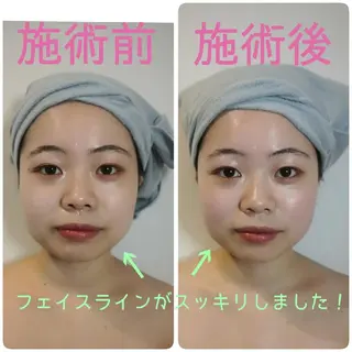 美容鍼/小顔&整体 nano.faceのエステ・リラクイメージ