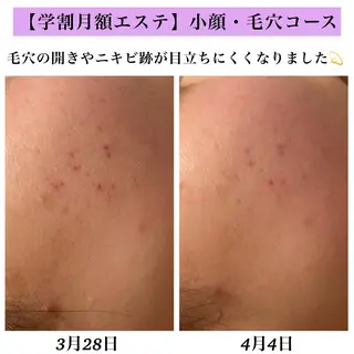 Bellesthe (ベルエステ)のエステ・リラクイメージ