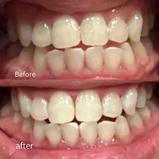 Balance facialのエステ・リラクイメージ