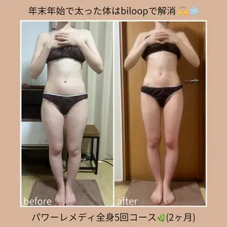 《本気痩せ×疲労改善 》  BILOOPのエステ・リラクイメージ