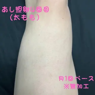 メンズ キッズ メンズ脱毛フェリッセ /男女🆗キッズ🆗のエステ・リラクイメージ