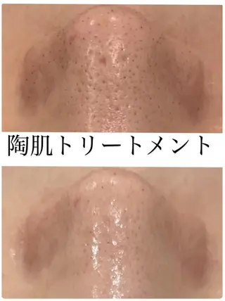 疲れ顔卒業✨肩こり 改善×小顔サロン 岡のエステ・リラクイメージ