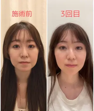 🌸美容鍼サロン🌸 メゾンブランシェ🌈のエステ・リラクイメージ