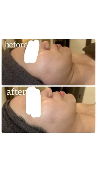 BEAUTY SALON R'sのエステ・リラクイメージ