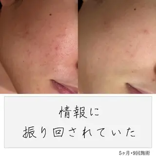 ニキビ経験者が施術 する専門サロン🌻のエステ・リラクイメージ