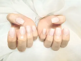 ネイル フットケア 巻き爪のネイルデザイン