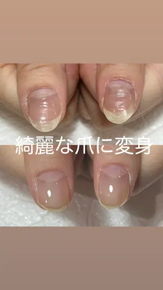 ネイル 自爪育成・巻き爪 補正講師 津蔵のネイルデザイン