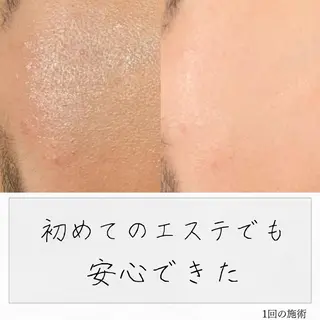 ニキビ経験者が施術 する専門サロン🌻のエステ・リラクイメージ