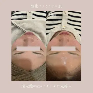Lyséa新宿 ♡kaoriのエステ・リラクイメージ