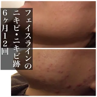 ミディアム カラー パーマ ヘアアレンジ メンズ キッズ ネイル マツエク・マツパ ニキビ・肌質改善専門 ♡人生が変わるサロンのエステ・リラクイメージ