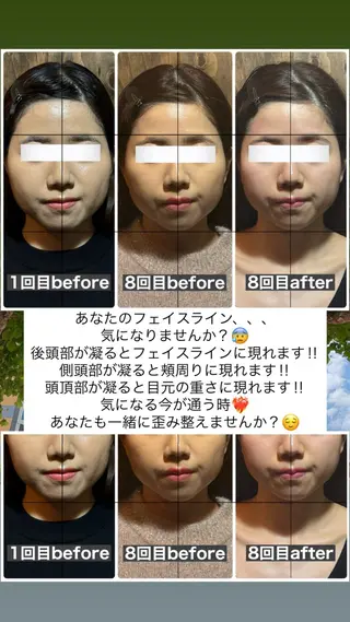 💎後悔させない小顔 矯正💎イトヤマ🌱のエステ・リラクイメージ