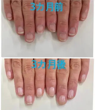 ネイル 久場 晴美のネイルデザイン