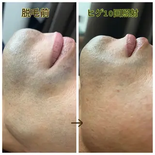 MINOA 井上🌷のエステ・リラクイメージ