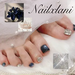ネイル Nail×Lani 深爪矯正対応◎のネイルデザイン